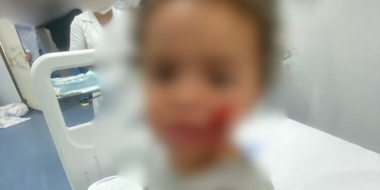 Bebê de 1 ano e 7 meses é atacado por pitbull em Marataízes, no Espírito Santo